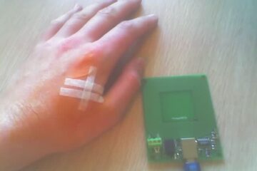 implanted microchip